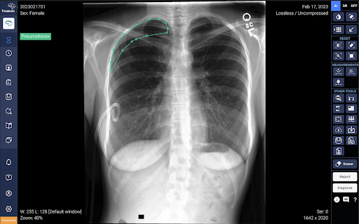 DrAid™ - AI for Radiology